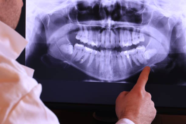 Best Urgent Dental Care for Toothaches in Collinsvle, IL